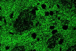 Anti-Glutamate Transporter Antibody, Glial serum, Chemicon®