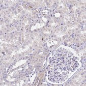 Anti-DBNDD2 antibody produced in rabbit Prestige Antibodies® Powered by Atlas Antibodies, affinity isolated antibody, buffered aqueous glycerol solution