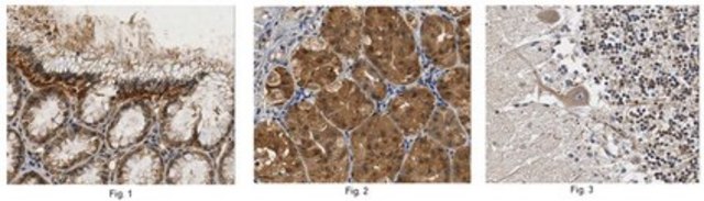 Anti-MPRIP Antibody from rabbit, purified by affinity chromatography