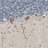 Anti-RPS6KB2 antibody produced in rabbit Prestige Antibodies® Powered by Atlas Antibodies, affinity isolated antibody, buffered aqueous glycerol solution