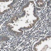 Anti-SEC62 antibody produced in rabbit Prestige Antibodies® Powered by Atlas Antibodies, affinity isolated antibody, buffered aqueous glycerol solution