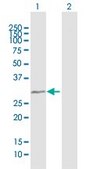 Anti-TBC1D7 antibody produced in mouse IgG fraction of antiserum, buffered aqueous solution