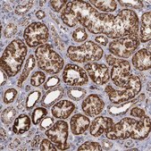 Anti-HSPD1 antibody produced in rabbit Prestige Antibodies® Powered by Atlas Antibodies, affinity isolated antibody, buffered aqueous glycerol solution