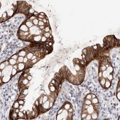 Anti-FAS antibody produced in rabbit Prestige Antibodies® Powered by Atlas Antibodies, affinity isolated antibody, buffered aqueous glycerol solution