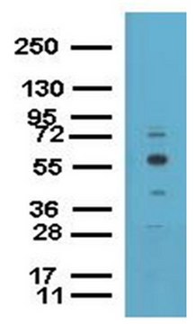 ChIPAb+ EED - ChIP Validated Antibody and Primer Set from rabbit
