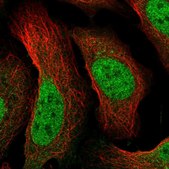 Anti-POLR2I antibody produced in rabbit Prestige Antibodies® Powered by Atlas Antibodies, affinity isolated antibody, buffered aqueous glycerol solution