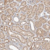 Anti-GNB1L antibody produced in rabbit Prestige Antibodies® Powered by Atlas Antibodies, affinity isolated antibody, buffered aqueous glycerol solution, ab1