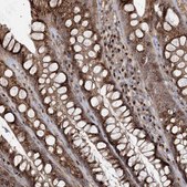 Anti-TRAF3IP2 antibody produced in rabbit Prestige Antibodies® Powered by Atlas Antibodies, affinity isolated antibody, buffered aqueous glycerol solution