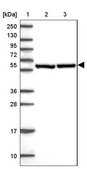 Anti-CCT6A antibody produced in rabbit Prestige Antibodies® Powered by Atlas Antibodies, affinity isolated antibody, buffered aqueous glycerol solution