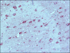 抗MAP2（2a+2b）抗体、マウスモノクローナル マウス宿主抗体 ~2 mg/mL, clone AP-20, purified from hybridoma cell culture