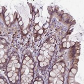 Anti-RAC1 antibody produced in rabbit Prestige Antibodies® Powered by Atlas Antibodies, affinity isolated antibody, buffered aqueous glycerol solution