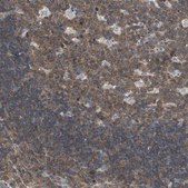 Anti-MAP4K2 antibody produced in rabbit Ab1, Prestige Antibodies® Powered by Atlas Antibodies, affinity isolated antibody, buffered aqueous glycerol solution