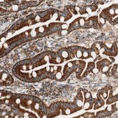 Anti-TOMM20 antibody produced in rabbit Prestige Antibodies® Powered by Atlas Antibodies, affinity isolated antibody, buffered aqueous glycerol solution