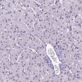 Anti-TBPL1 antibody produced in rabbit Prestige Antibodies® Powered by Atlas Antibodies, affinity isolated antibody, buffered aqueous glycerol solution