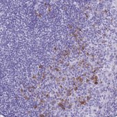 Anti-BEST4 antibody produced in rabbit Prestige Antibodies® Powered by Atlas Antibodies, affinity isolated antibody, buffered aqueous glycerol solution