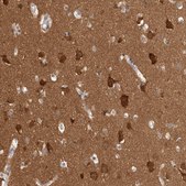Anti-BAIAP2 antibody produced in rabbit Prestige Antibodies® Powered by Atlas Antibodies, affinity isolated antibody, buffered aqueous glycerol solution