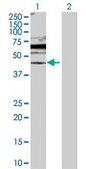 Anti-DUSP6 antibody produced in rabbit purified immunoglobulin, buffered aqueous solution