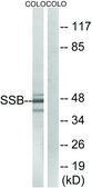 Anti-SSB antibody produced in rabbit affinity isolated antibody