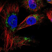 Anti-SLC25A20 antibody produced in rabbit Prestige Antibodies® Powered by Atlas Antibodies, affinity isolated antibody, buffered aqueous glycerol solution