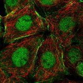 Anti-NCOA5 antibody produced in rabbit Prestige Antibodies® Powered by Atlas Antibodies, affinity isolated antibody, buffered aqueous glycerol solution