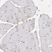 Anti-HESX1 antibody produced in rabbit Prestige Antibodies® Powered by Atlas Antibodies, affinity isolated antibody, buffered aqueous glycerol solution