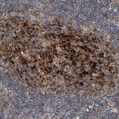 Anti-SDCBP antibody produced in rabbit Prestige Antibodies® Powered by Atlas Antibodies, affinity isolated antibody, buffered aqueous glycerol solution