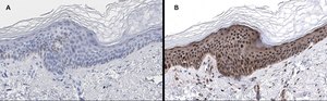 Anti-phos-AMPKα (Thr172) Antibody, clone 5J23 , ZooMAb® Rabbit Monoclonal recombinant, expressed in HEK 293 cells
