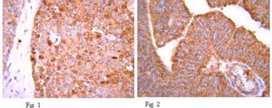 Anti-Bax (NT) Antibody from rabbit