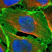 Anti-EPB41L2 antibody produced in rabbit Prestige Antibodies® Powered by Atlas Antibodies, affinity isolated antibody, buffered aqueous glycerol solution