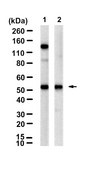 Anti-β2-Adrenergic Receptor Antibody, clone 2B23 ZooMAb® Rabbit Monoclonal recombinant, expressed in HEK 293 cells
