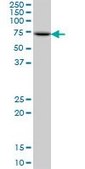 Anti-PES1 antibody produced in mouse IgG fraction of antiserum, buffered aqueous solution