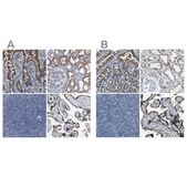 Anti-ACADVL antibody produced in rabbit Prestige Antibodies® Powered by Atlas Antibodies, affinity isolated antibody, buffered aqueous glycerol solution, Ab2