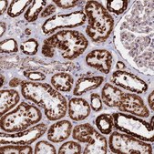 Anti-CHCHD3 antibody produced in rabbit Prestige Antibodies® Powered by Atlas Antibodies, affinity isolated antibody, buffered aqueous glycerol solution