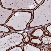 Anti-SALL1 antibody produced in rabbit Prestige Antibodies® Powered by Atlas Antibodies, affinity isolated antibody, buffered aqueous glycerol solution