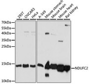 Anti-NDUFC2 antibody produced in rabbit