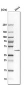 Anti-DNAJB11 antibody produced in rabbit Ab1, Prestige Antibodies® Powered by Atlas Antibodies, affinity isolated antibody, buffered aqueous glycerol solution