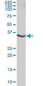 Anti-HLA-DRB3 antibody produced in mouse IgG fraction of antiserum, buffered aqueous solution