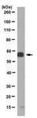 Anti-Gamma-1-Tubulin, clone 6H3.1 Antibody clone 6H3.1, from mouse