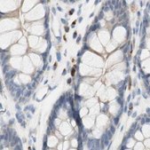 Anti-MANEA antibody produced in rabbit Ab2, Prestige Antibodies® Powered by Atlas Antibodies, affinity isolated antibody, buffered aqueous glycerol solution