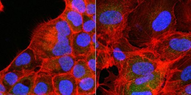 Anti-Rac1b Antibody Upstate&#174;, from rabbit