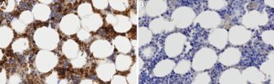 Anti-IL2RB Antibody, clone 4D2 ZooMAb® Rabbit Monoclonal recombinant, expressed in HEK 293 cells
