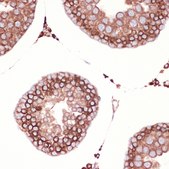 Anti-Peroxiredoxin 4 (PRDX4) Antibody, clone 9E7V0, Rabbit Monoclonal