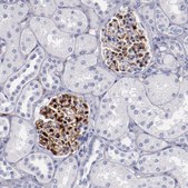 Anti-PRX antibody produced in rabbit Prestige Antibodies® Powered by Atlas Antibodies, affinity isolated antibody, buffered aqueous glycerol solution