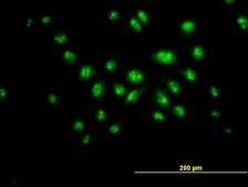 Anti-DKC1 antibody produced in mouse purified immunoglobulin, buffered aqueous solution
