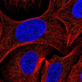 Anti-AP3S2 antibody produced in rabbit Prestige Antibodies® Powered by Atlas Antibodies, affinity isolated antibody, buffered aqueous glycerol solution