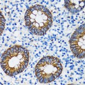 Anti- α-Catenin antibody produced in rabbit
