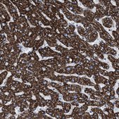 Anti-ECHS1 antibody produced in rabbit Prestige Antibodies® Powered by Atlas Antibodies, affinity isolated antibody, buffered aqueous glycerol solution, Ab1