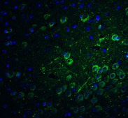 Anti-PACS1 antibody produced in rabbit affinity isolated antibody