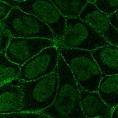 Anti-ITGB6 antibody produced in rabbit Prestige Antibodies® Powered by Atlas Antibodies, affinity isolated antibody, buffered aqueous glycerol solution