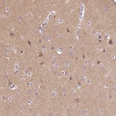 Anti-DNAJC6 antibody produced in rabbit Prestige Antibodies® Powered by Atlas Antibodies, affinity isolated antibody, buffered aqueous glycerol solution